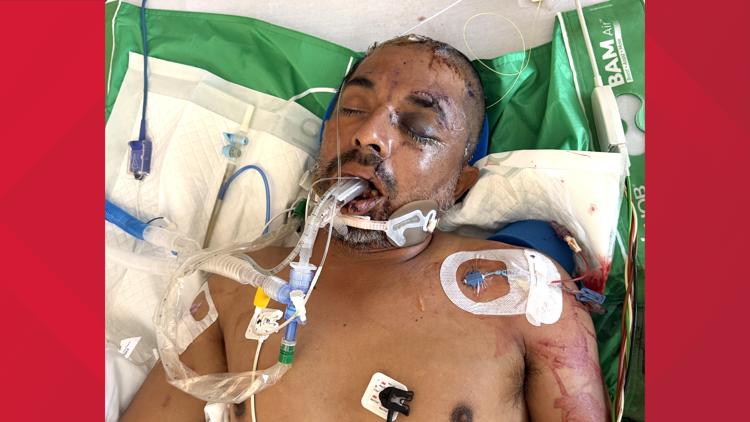 University Hospital asks for help identifying unconscious patient hit by truck Saturday evening — KENS 5 (San Antonio), Dublin Health news